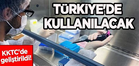 C­o­r­o­n­a­ ­v­i­r­ü­s­ ­t­e­s­p­i­t­i­n­d­e­ ­k­u­l­l­a­n­ı­l­a­c­a­k­ ­t­a­n­ı­ ­k­i­t­l­e­r­i­n­i­ ­T­ü­r­k­i­y­e­­d­e­ ­g­e­l­i­ş­t­i­r­e­n­ ­8­ ­f­i­r­m­a­